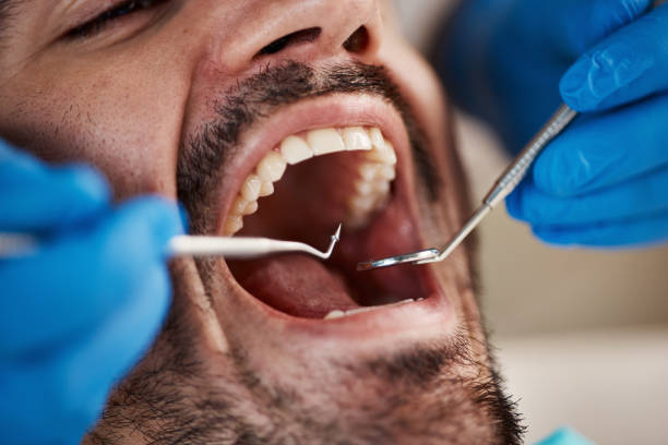 Best Cracked Tooth Emergency Dentist  in Yelm, WA